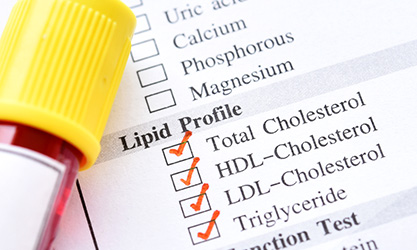 What is Lipid Profile Test