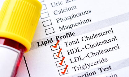 Cholesterol test: Control Your Cholesterol, Control Your Health