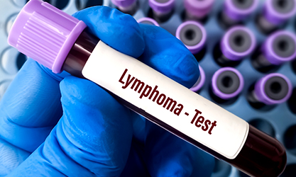 Lymphoma