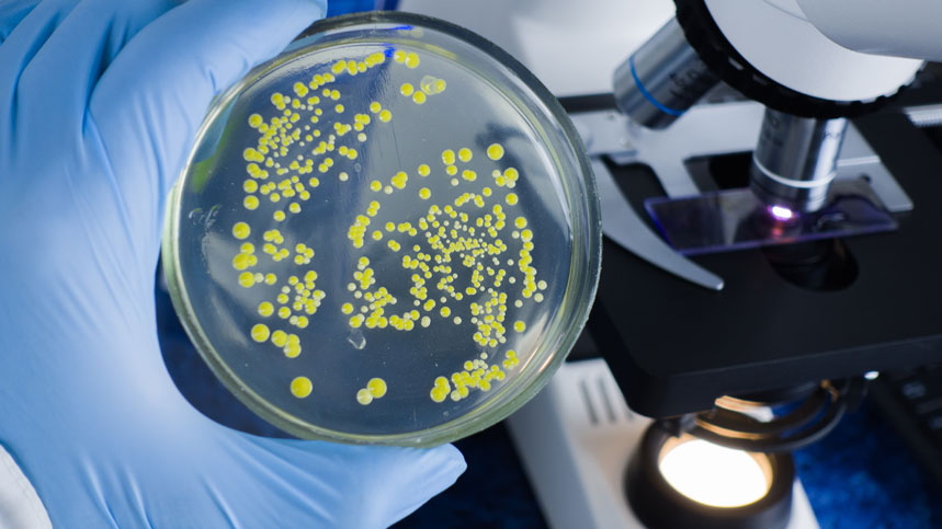 GenExpert Testing: Rapid and Accurate TB Diagnosis