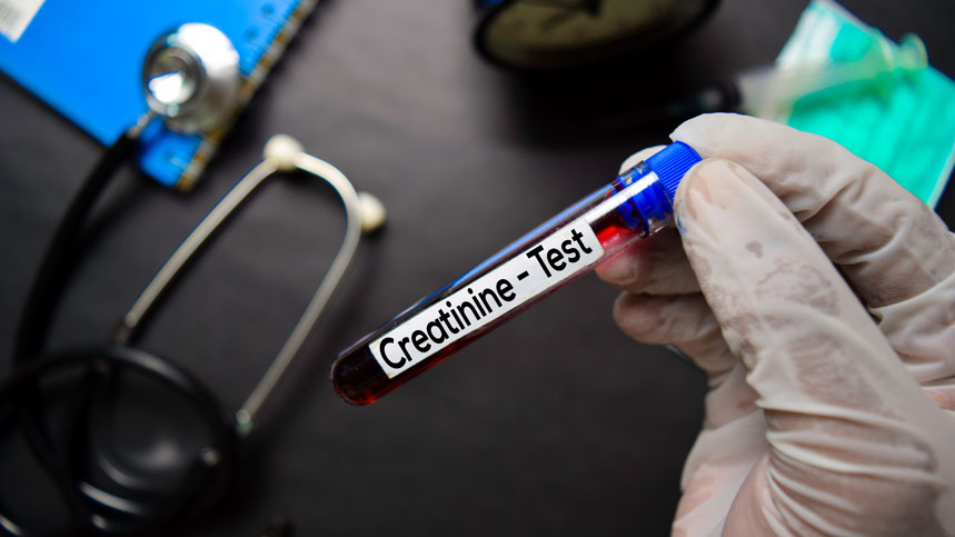 Serum Creatinine and GFR: Assessing Kidney Health