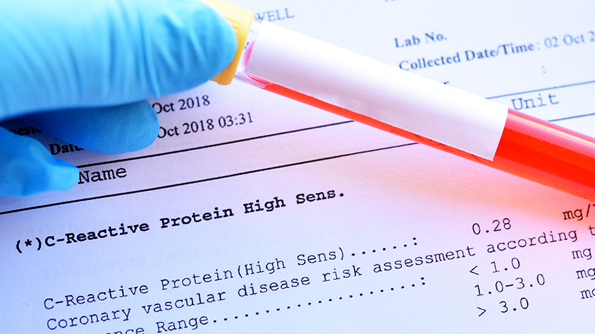 Understanding Cardiac Biomarkers: What Do They Reveal?