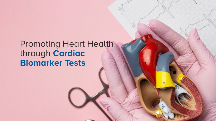 Promoting Heart Health through Cardiac Biomarker Tests