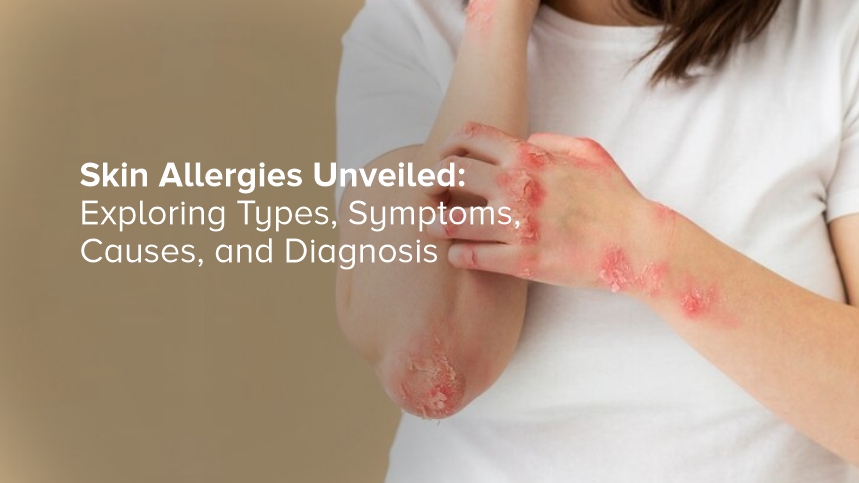 Skin Allergies Unveiled: Exploring Types, Symptoms, Causes, and Diagnosis