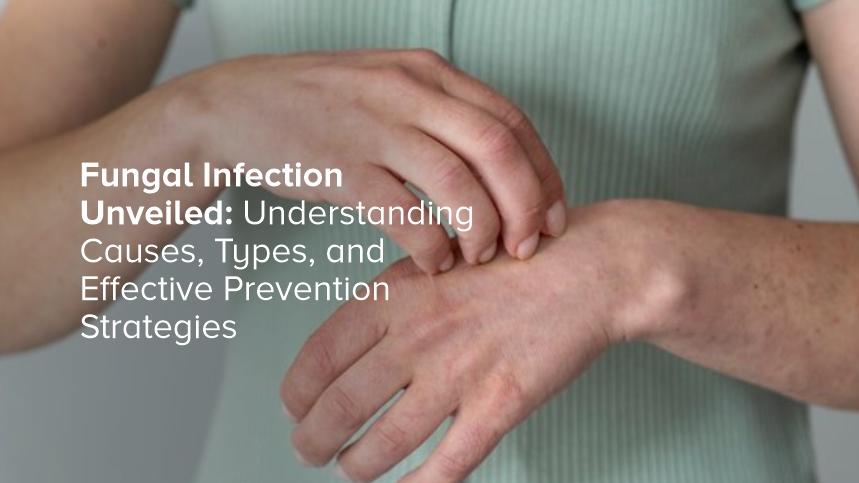 Fungal Infection Unveiled: Understanding Causes, Types, and Effective Prevention Strategies