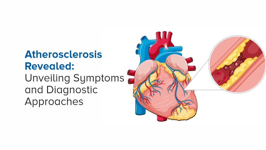 Atherosclerosis Revealed: Unveiling Symptoms and Diagnostic Approaches