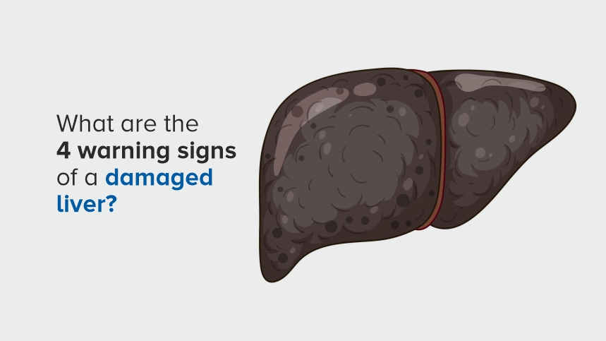 Recognizing the 4 Warning Signs of a Damaged Liver
