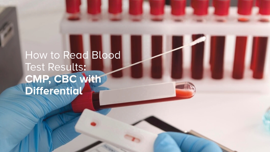 How to Read Blood Test Results: CMP, CBC with Differential
