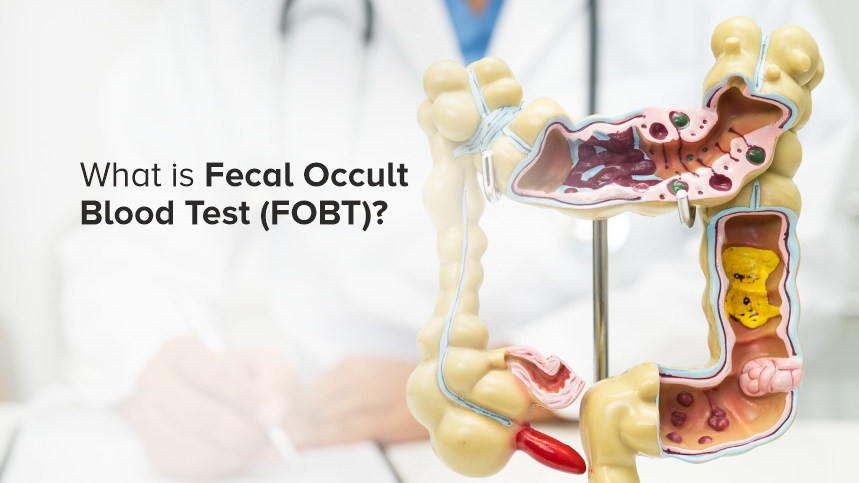 The Complete Guide to Fecal Occult Blood Test (FOBT) – Your Shield against Colorectal Cancer