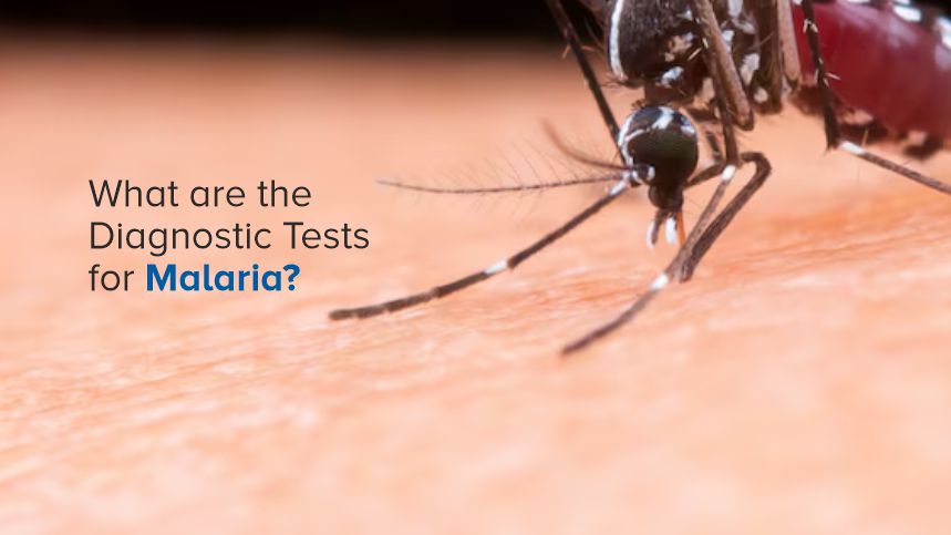 Unraveling the Mysteries of Malaria Diagnosis