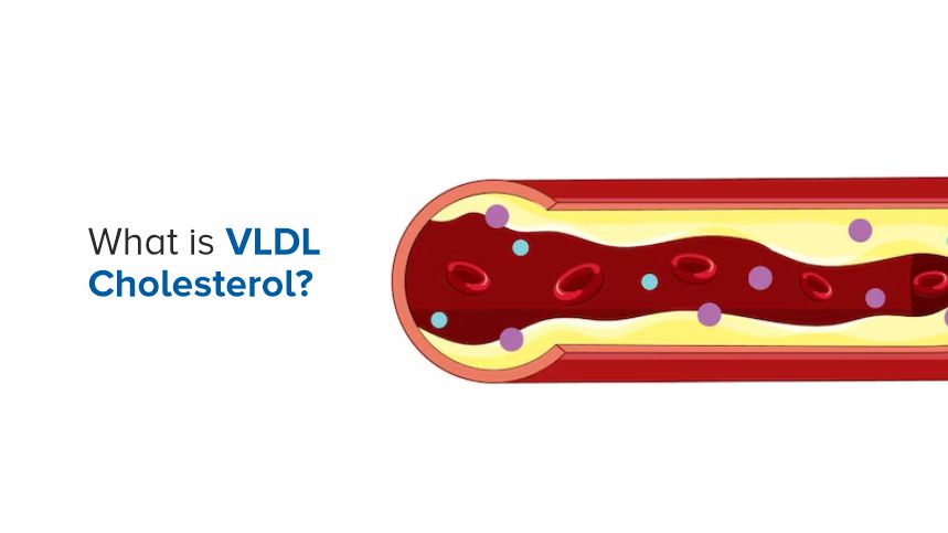 What Everyone Should Know About VLDL Cholesterol