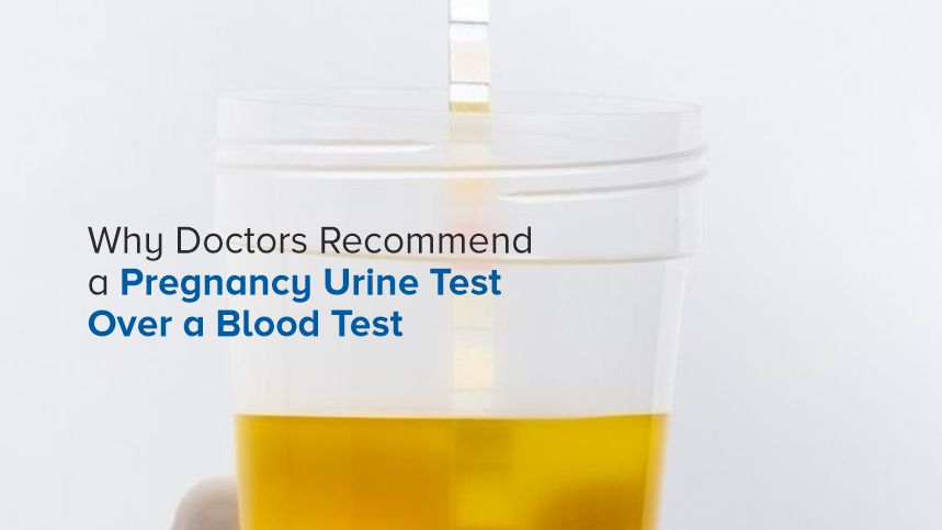 Why Doctors Recommend a Pregnancy Urine Test Over a Blood Test