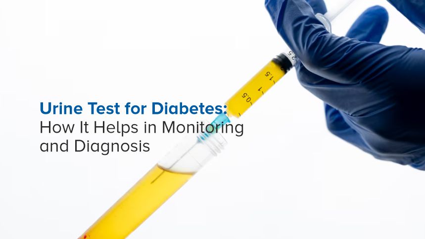 Urine Test for Diabetes: How It Helps in Monitoring and Diagnosis
