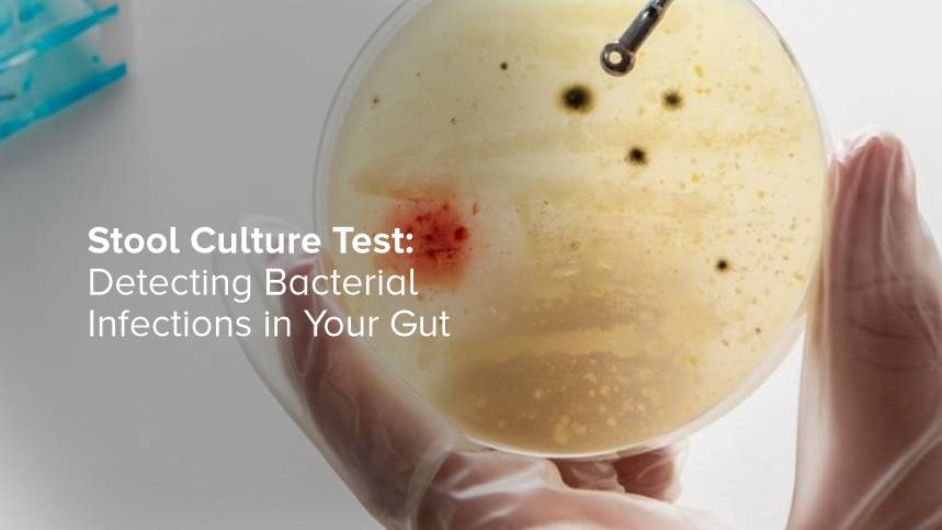 Stool Culture Test: Detecting Bacterial Infections in Your Gut