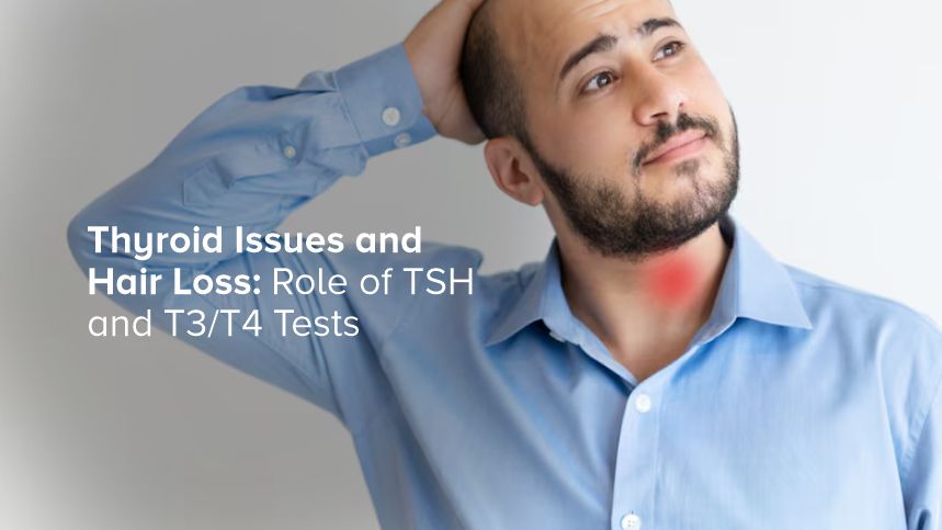 Thyroid Issues and Hair Loss: Role of TSH and T3/T4 Tests