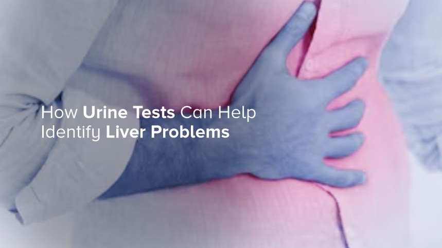 How Urine Tests Can Help Identify Liver Problems