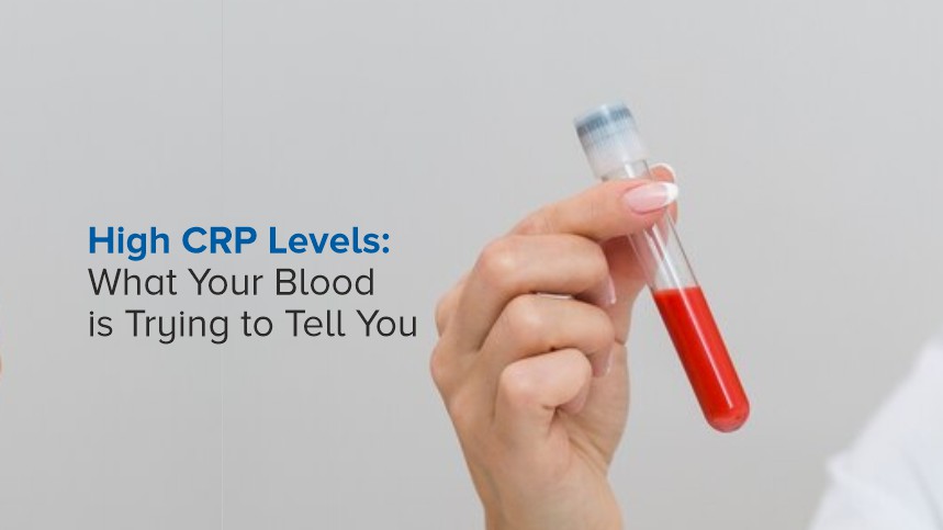 High CRP Levels: What Your Blood is Trying to Tell You