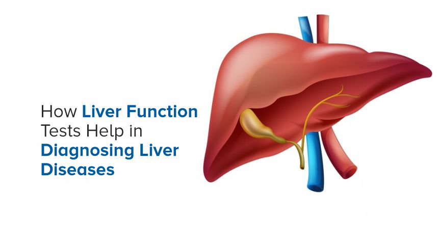 How Liver Function Tests Help in Diagnosing Liver Diseases