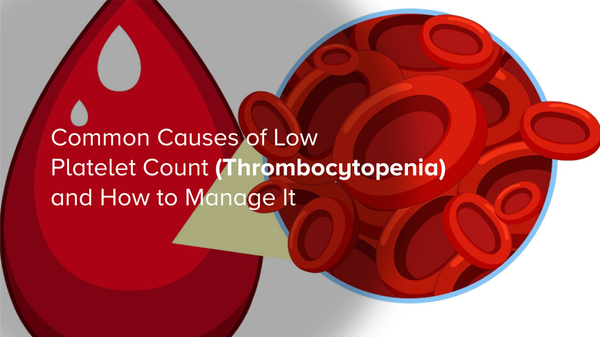 Common Causes of Low Platelet Count (Thrombocytopenia) and How to Manage It