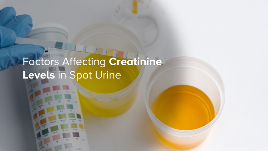 Factors Affecting Creatinine Levels in Spot Urine