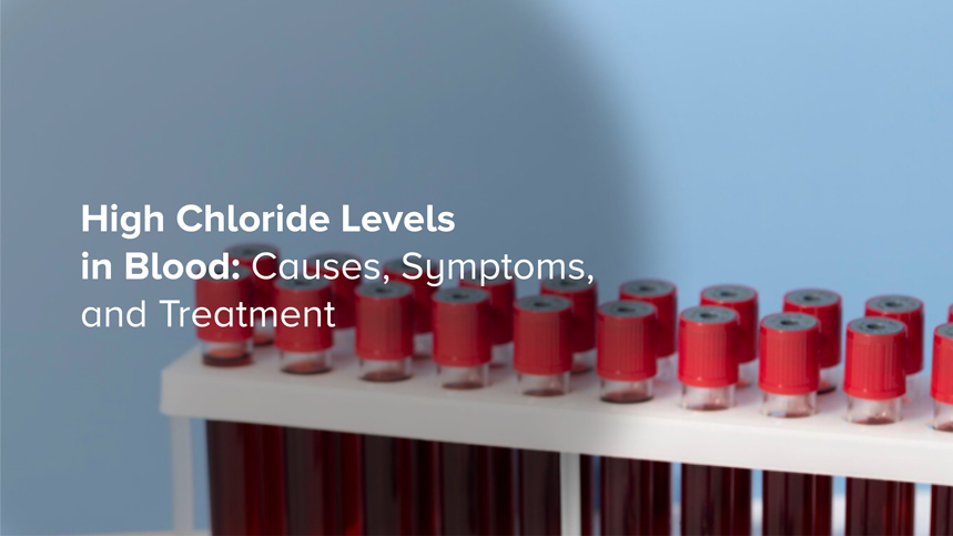 High Chloride Levels in Blood: Causes, Symptoms, and Treatment