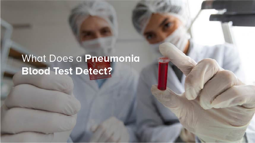 What Does a Pneumonia Blood Test Detect?