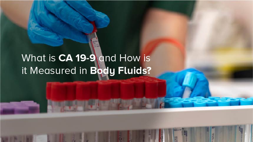 What is CA 19-9 and How is it Measured in Body Fluids?