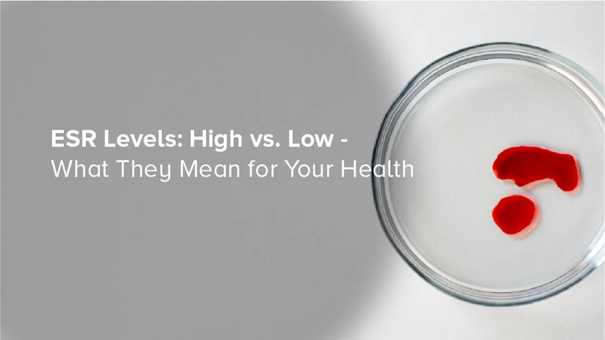 ESR Levels: High vs. Low – What They Mean for Your Health